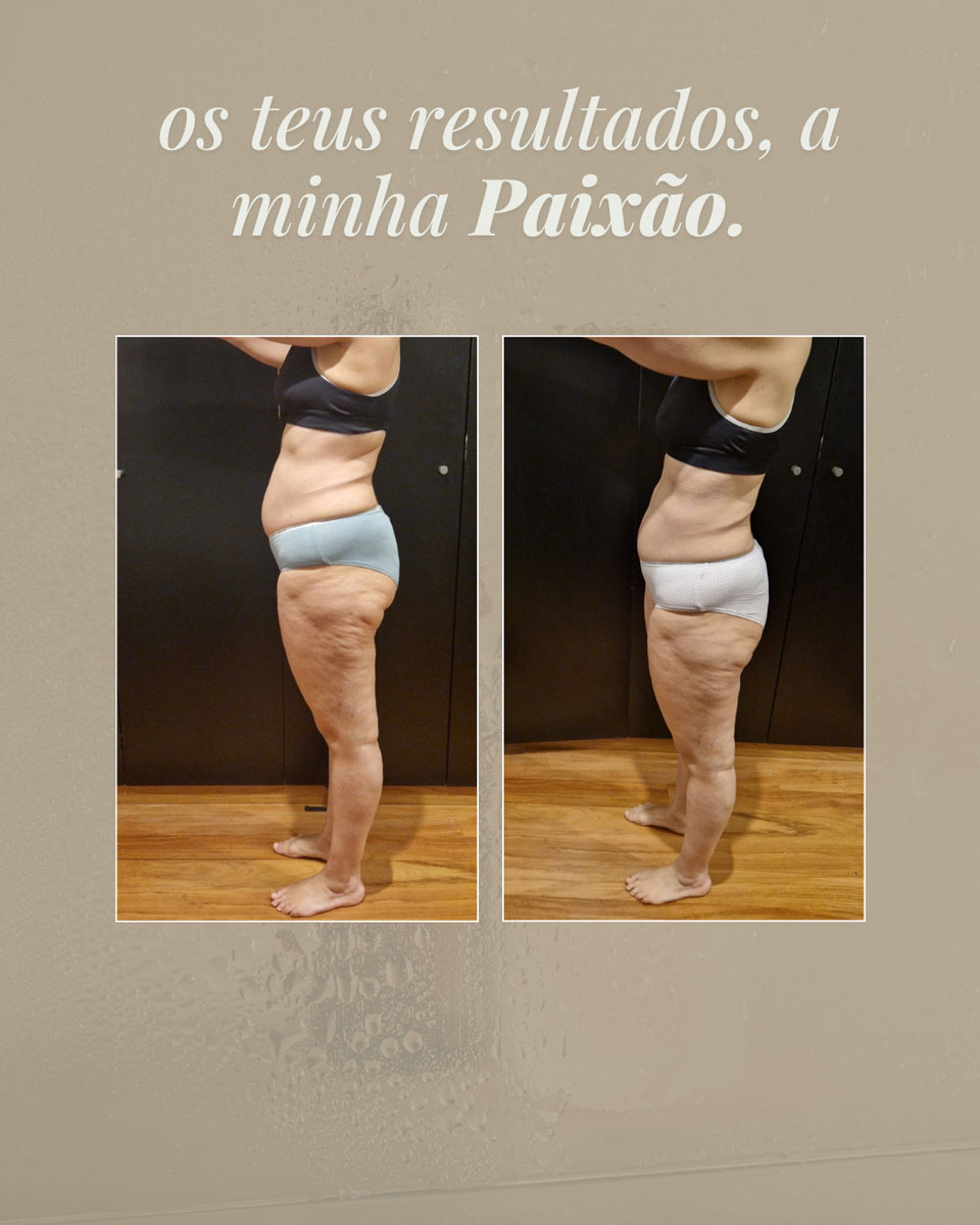 Transformation 3